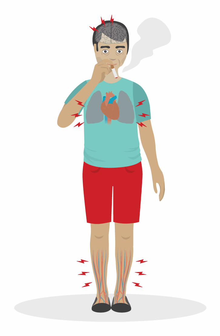 Rauchen erhht den Blutdruck